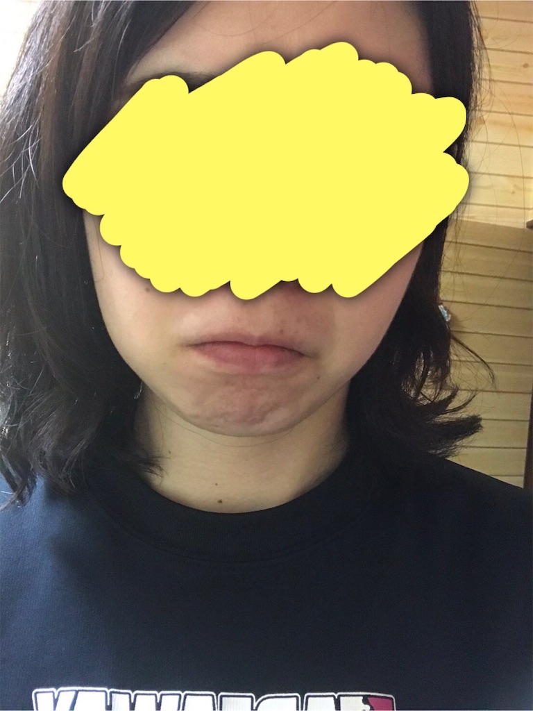 f:id:kinoko36:20190712230417j:image f:id:kinoko36:20190712230417j:image